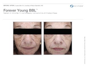 before and after BBL treatment