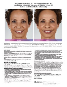 fillers article