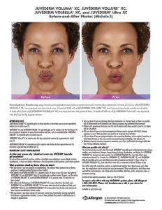 fillers article