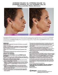 fillers article