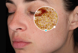 facial assessment consultation