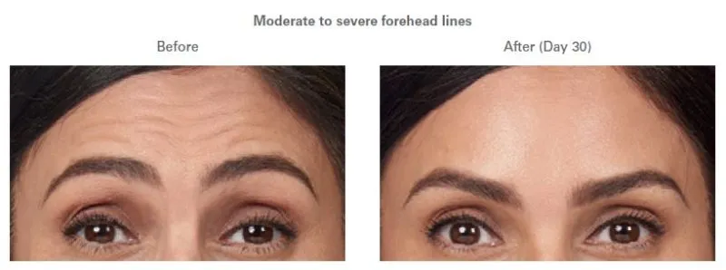 before and after face photo