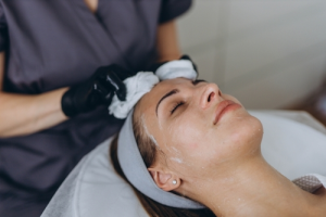 woman getting chemical peels in St. Louis